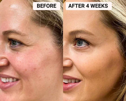Glow™ RegenMask Skin Rejuvenating LED Face + Free Neck Mask