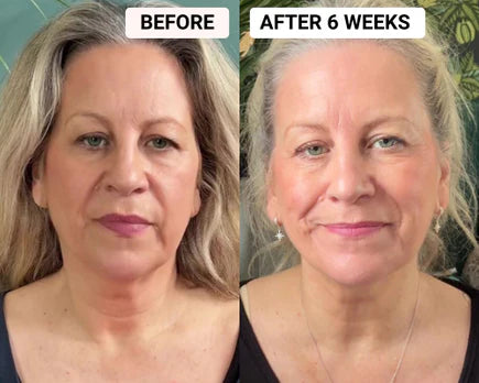 Glow™ RegenMask Skin Rejuvenating LED Face + Free Neck Mask